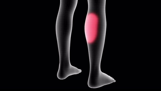 女性x射线全息图的3d动画显示了带有alpha通道的小腿背部区域的疼痛区域