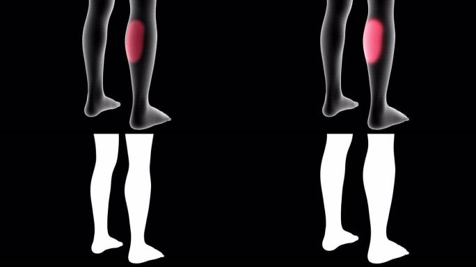 女性x射线全息图的3d动画显示了带有alpha通道的小腿背部区域的疼痛区域