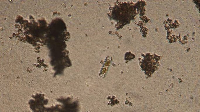 硅藻的显微镜检查。单细胞生物的放大倍数为150x。玻璃和pennales制成的细胞壁往往会拉长。