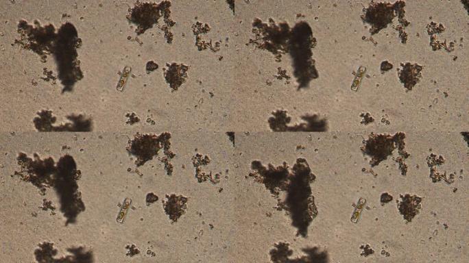 硅藻的显微镜检查。单细胞生物的放大倍数为150x。玻璃和pennales制成的细胞壁往往会拉长。