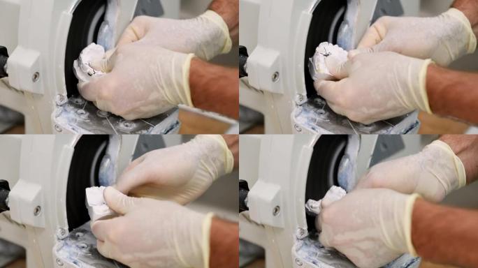 医生在正畸诊所的磨床上处理人颌骨的石膏模型。对准器的控制和诊断强制转换。