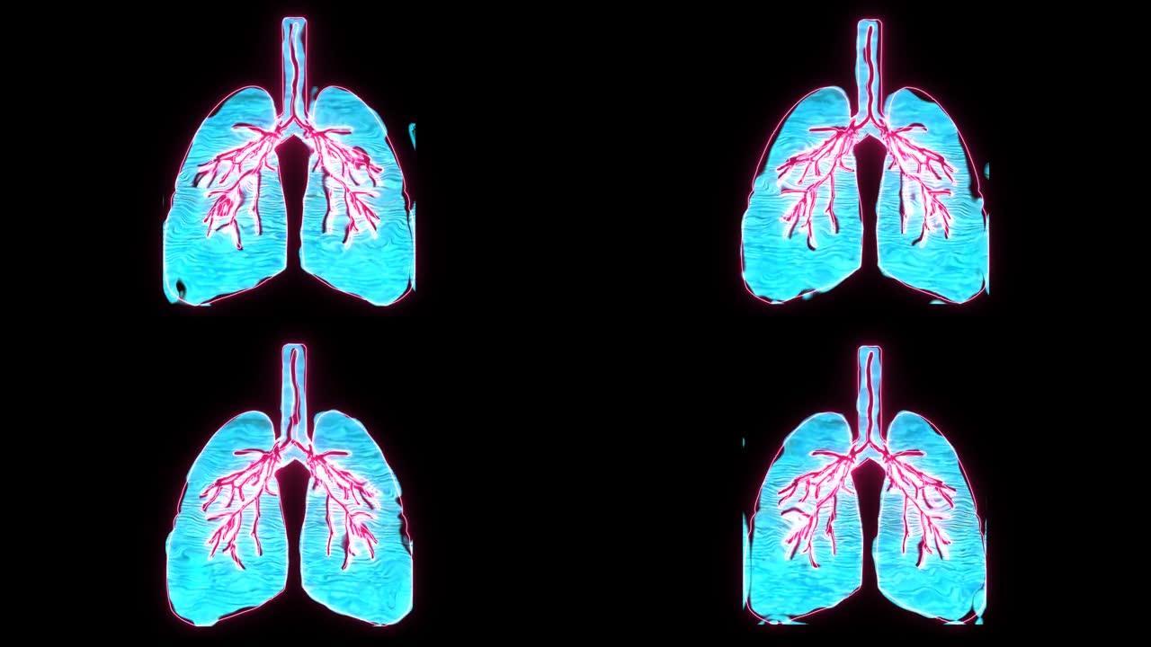 全息数字肺中的肺水肿，它是窒息的象征，非常危险