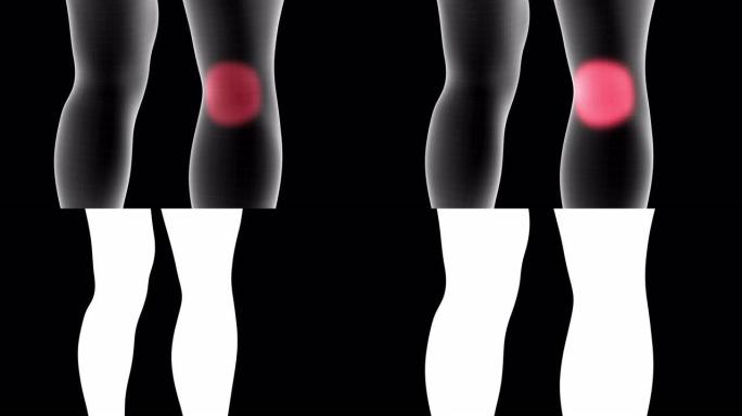 男性x射线全息图的3d动画显示了带有alpha通道的腿部膝盖背部区域的疼痛区域