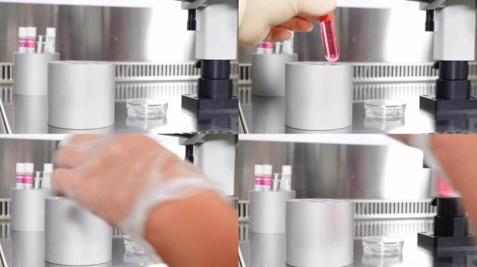 试管婴儿手术的特写镜头。胚胎学家在保护手套中从培养皿中的塑料试管中滴下培养基，用剥蚀移液针收集卵。生