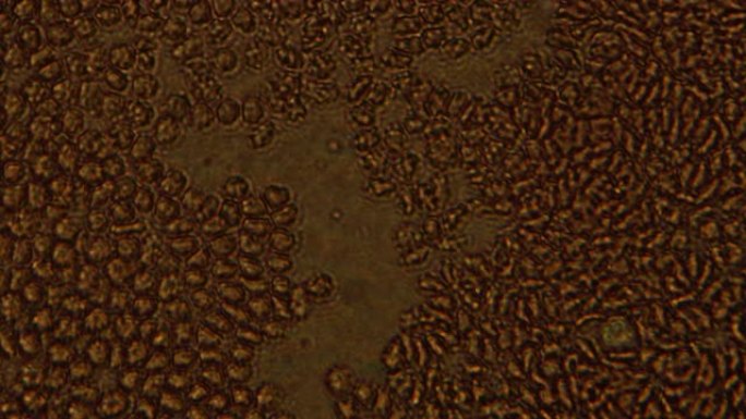 人体血细胞测试的显微镜。显微镜下红细胞详细移动的放大300倍。实验室分析。