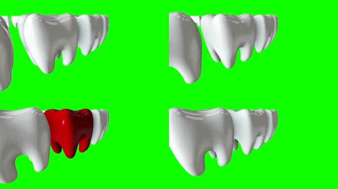一排白色牙齿中的红牙。3D渲染。牙科，出众，经营理念。