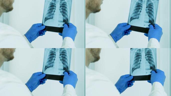 一名男医生在他的办公室里检查肺部的x光，主治医师检查他的病人的疾病，肺炎，肺水肿