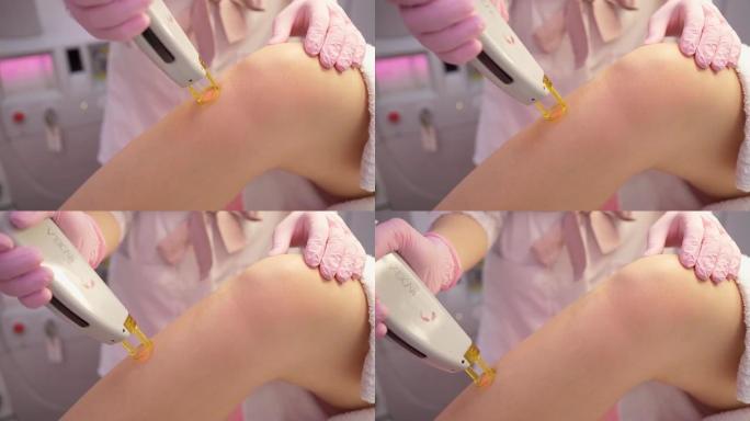 美容师沙龙的脱毛程序视频镜头激光脉冲。