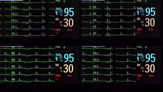 生命体征监测屏幕心率
