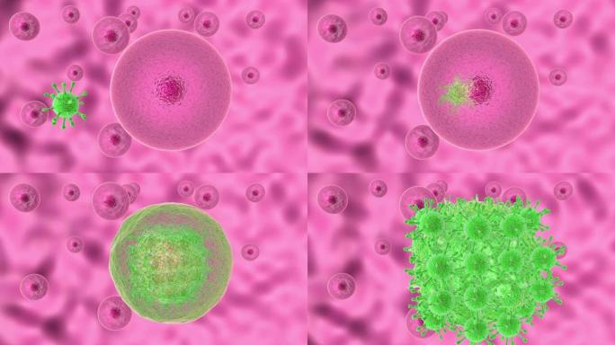 用冠状病毒感染活细胞的过程的3D动画。新型冠状病毒肺炎在活细胞内复制，然后离开人类细胞导致细胞凋亡。