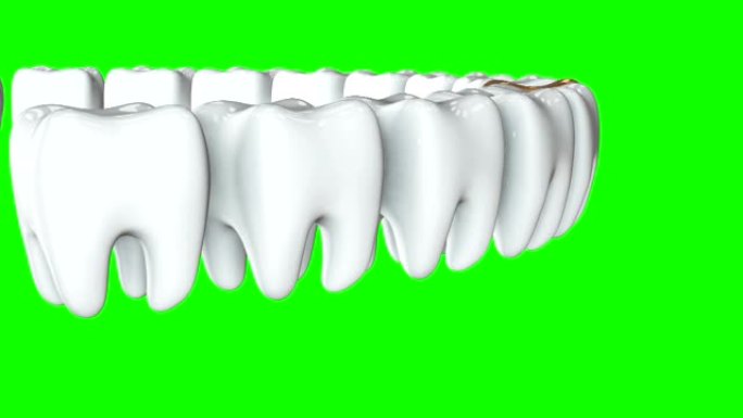 一排白色牙齿中的金色牙齿。3D渲染。牙科，出众，经营理念。