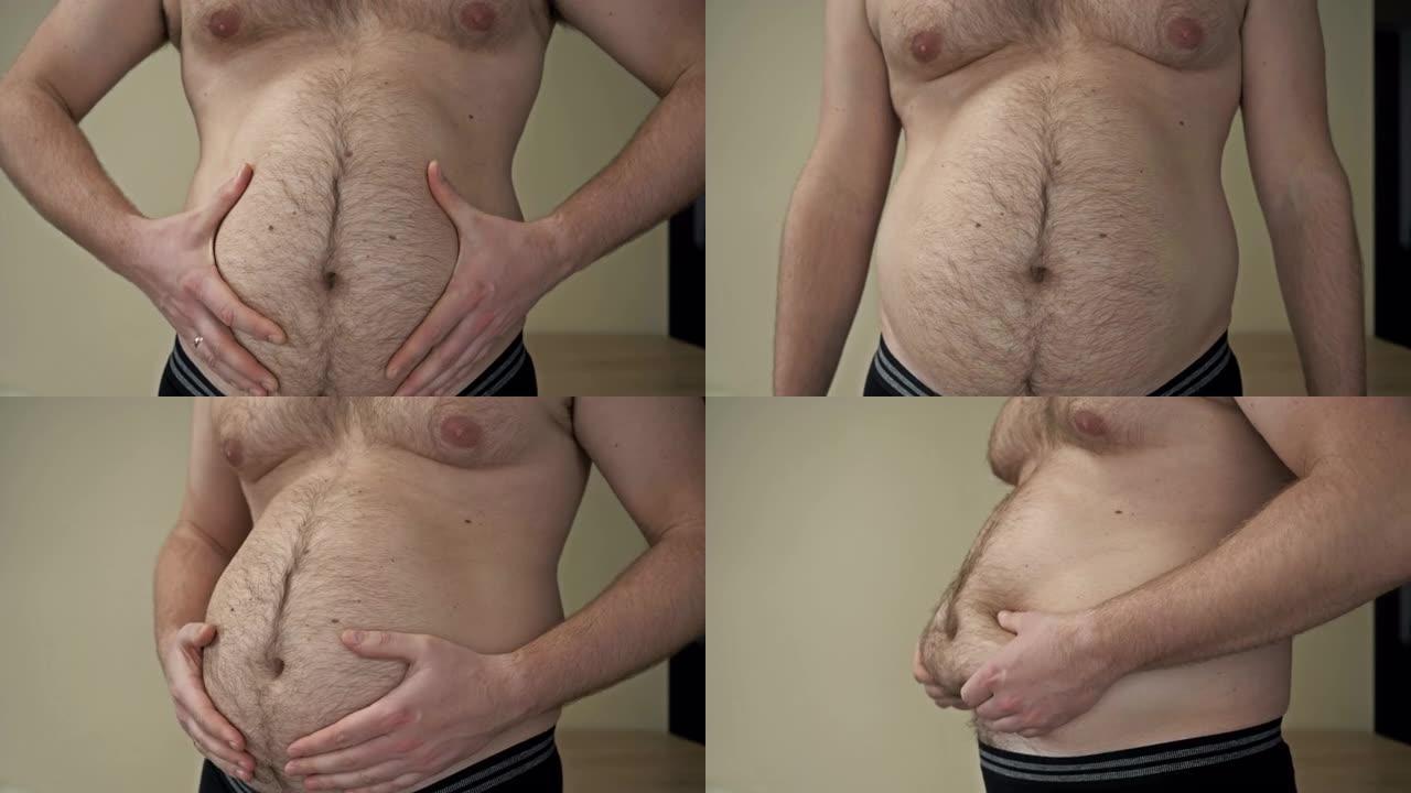 这个胖乎乎的男人腹部有多余脂肪的褶皱。超重的问题