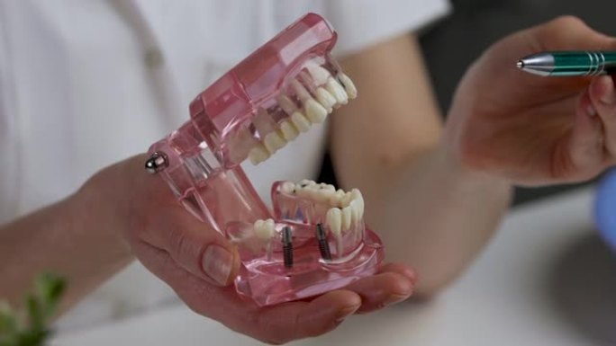 牙科和种植学-牙科种植学家与人的牙齿颌骨模型在手