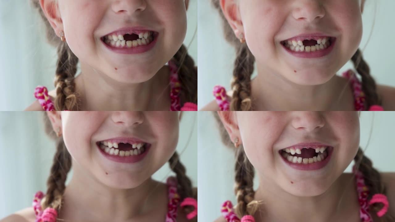 一个女孩的特写微笑。一个6-7岁的漂亮小女孩掉了乳牙。乳牙脱落，恒牙更换。儿童是牙科。