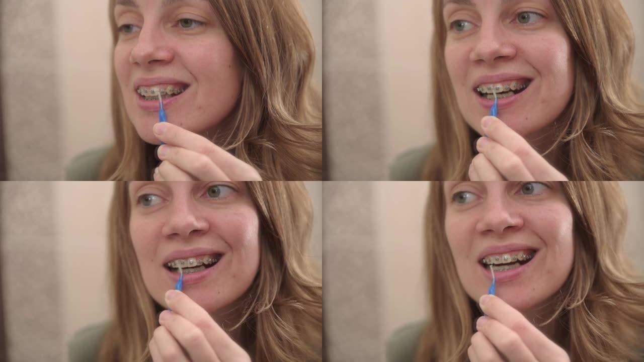 女人用牙刷清洁牙套。牙套护理