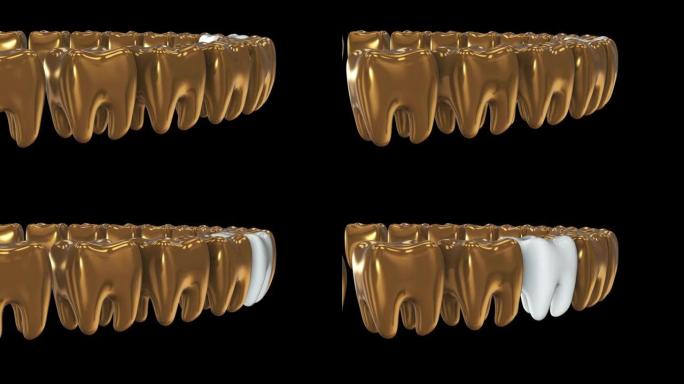 一排金牙中的白牙。3D渲染。牙科，出众，经营理念