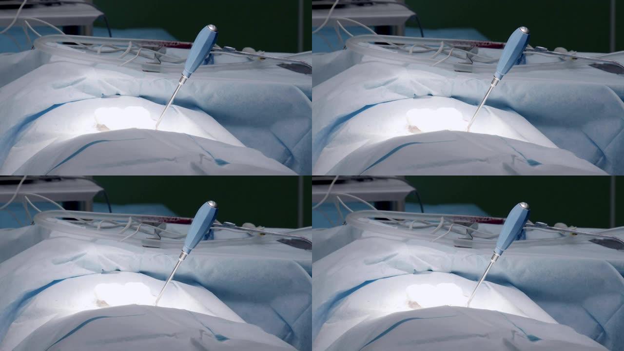 全身麻醉下的患者被无菌织物覆盖，呼吸，躺在手术台上