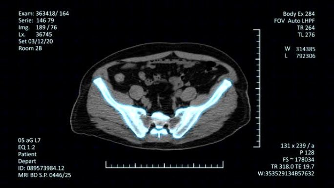 高科技放射学检查图像