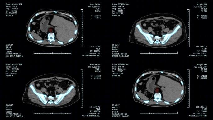 高科技放射学检查图像