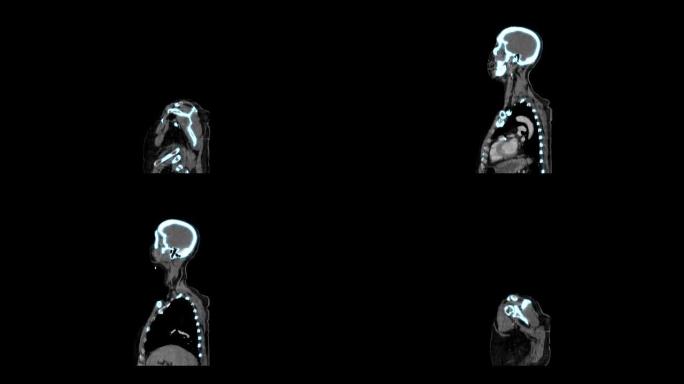 医用CT或CAT图像MRI扫描仪显示