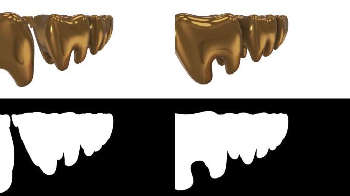 一排金牙中的白牙。3D渲染。牙科，出众，经营理念