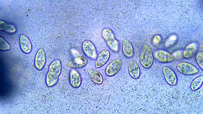 微生物-纤毛虫和细菌