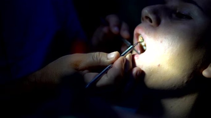 腔内牙齿香奈儿填充应用期间牙医的女孩