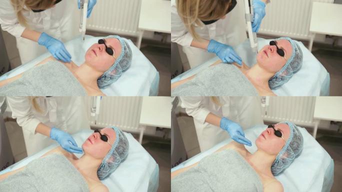 女性面部激光光子嫩肤和碳剥离。黑色面罩。皮肤病学和美容学。使用手术激光。