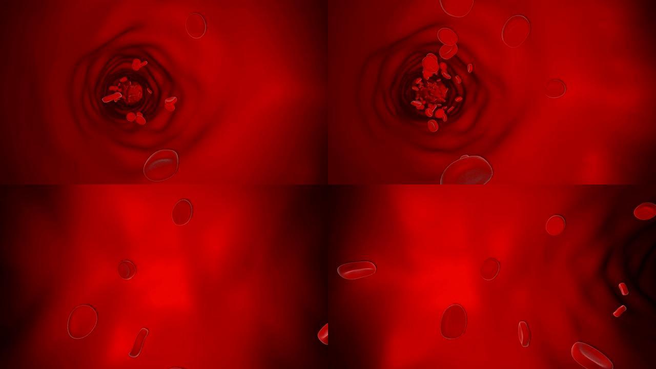 红细胞-4K