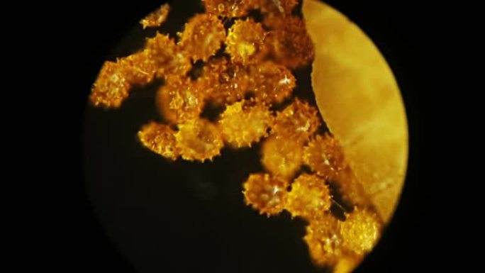 黄色花粉。自身免疫性疾病。强大的过敏原。显微镜下的花粉。人类最常见的过敏原之一。