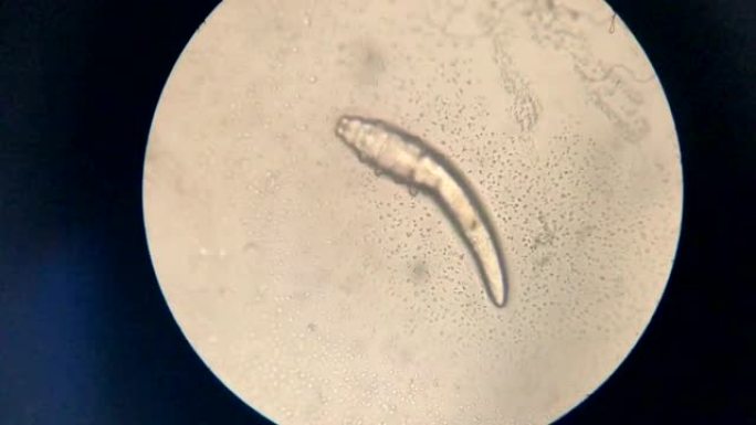 显微镜中的螨虫