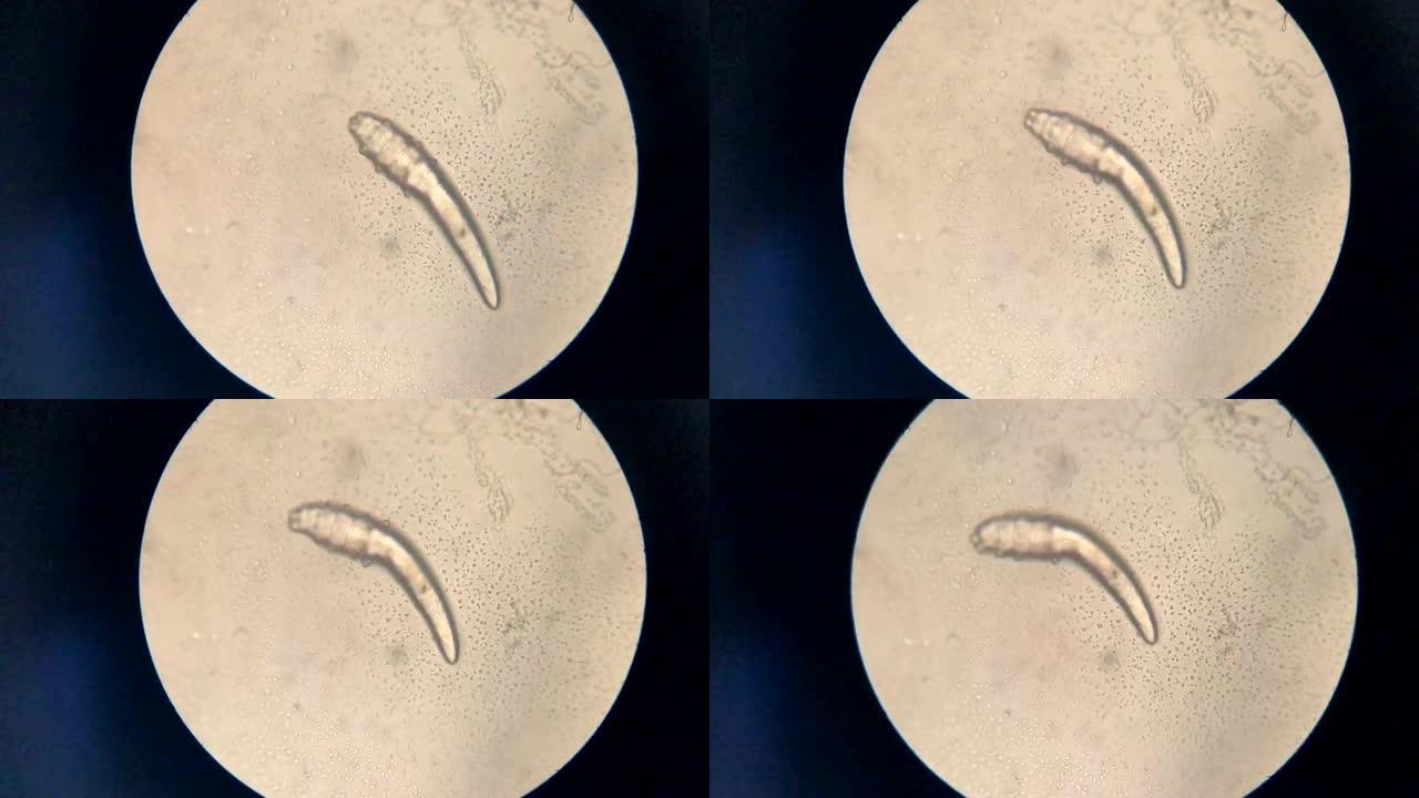 显微镜中的螨虫