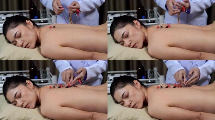 年轻女子背部接受电刺激器针灸治疗