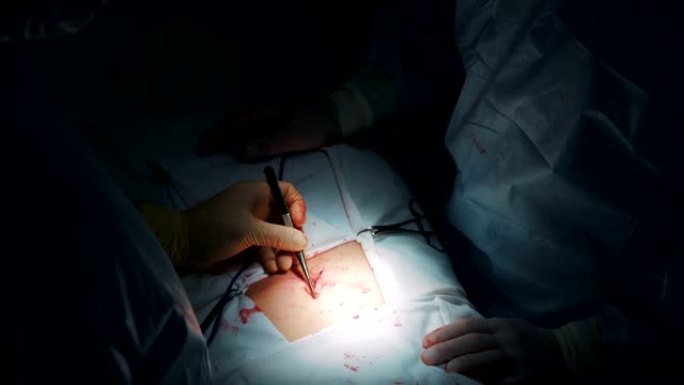 近距离外科医生用特殊仪器为患者做腹部手术，弱光场景