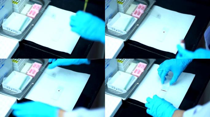 年轻科学家在实验室进行血液涂片检查