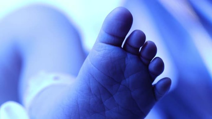 光疗下婴儿新生婴儿脚的特写