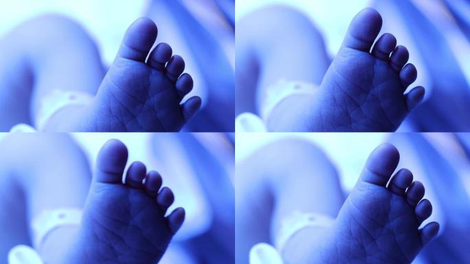 光疗下婴儿新生婴儿脚的特写
