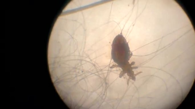 显微镜中的螨虫显微镜中的螨虫
