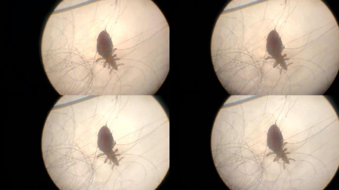 显微镜中的螨虫显微镜中的螨虫