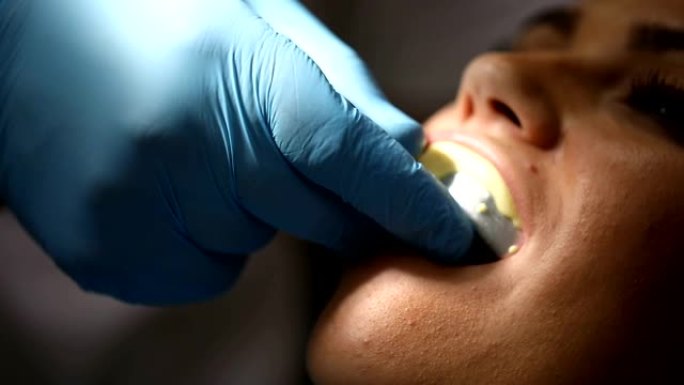 牙医服用牙齿模具