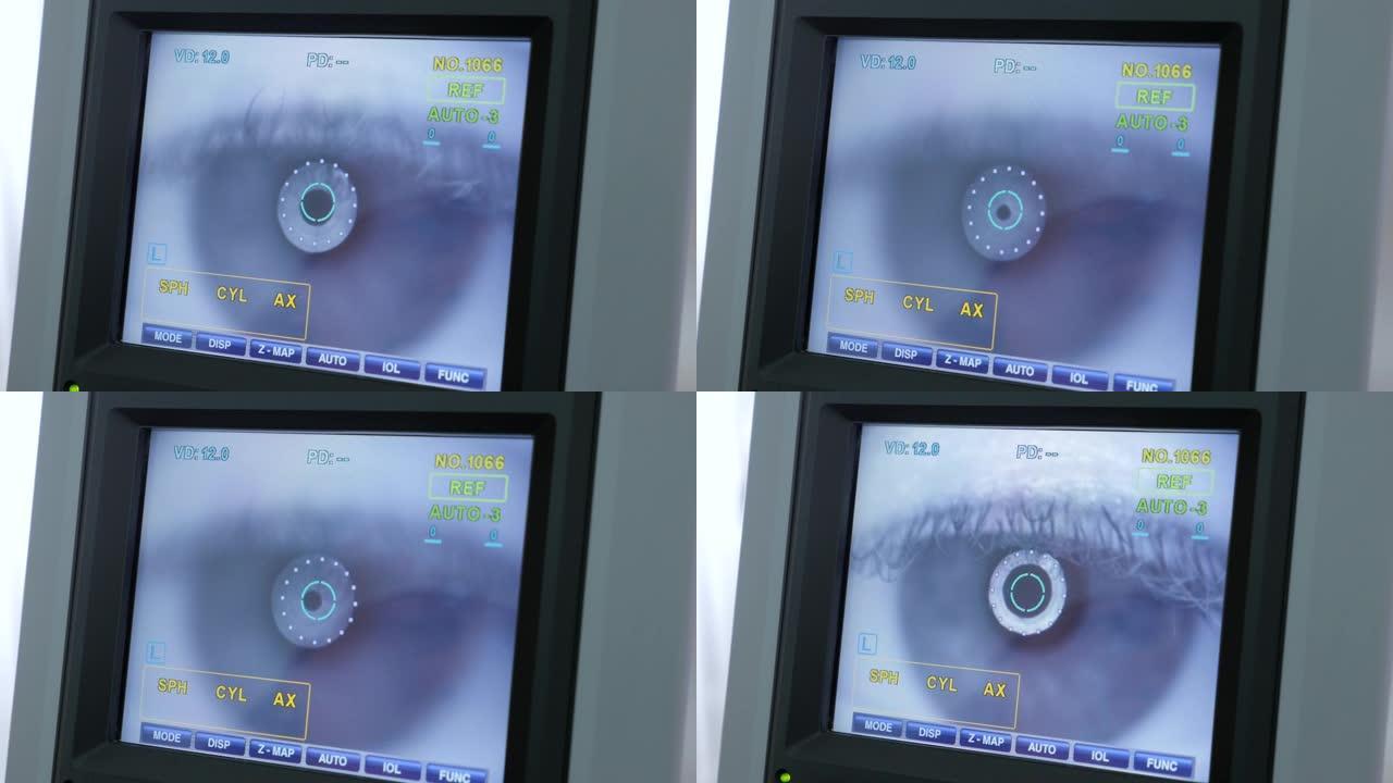 现代眼科器械在临床上的设备。角膜曲率计-现代自动机器检查眼球。