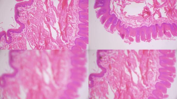 舌组织横断面