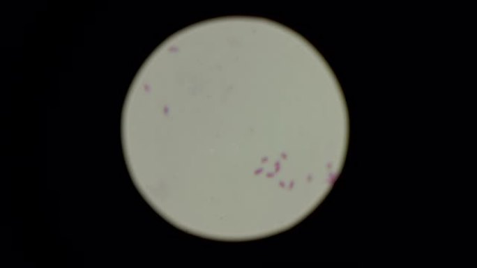显微镜下念珠菌孢子的特征。实验室和医学研究概念。