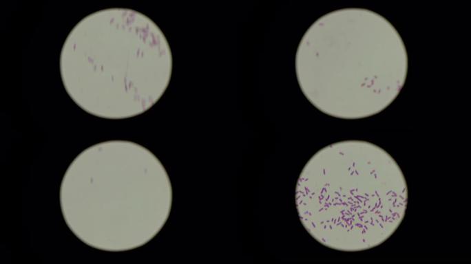 显微镜下念珠菌孢子的特征。实验室和医学研究概念。