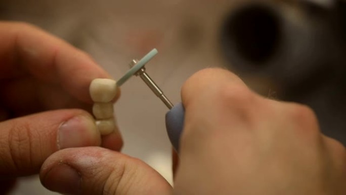 牙科技师制造人造牙齿