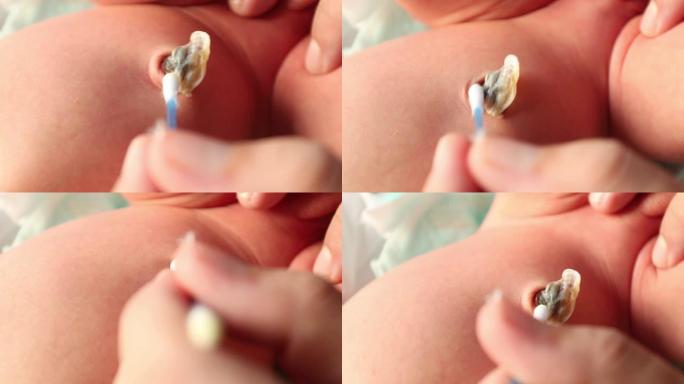母亲清洁新生儿脐带出生后，婴儿生命的第一周