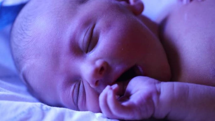 紫外线照射下新生婴儿在光疗灯下治疗
