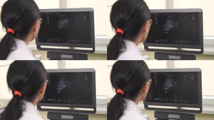 一位专业女医生在做医学检查时看着超声仪的监视器的特写镜头。医疗保健概念