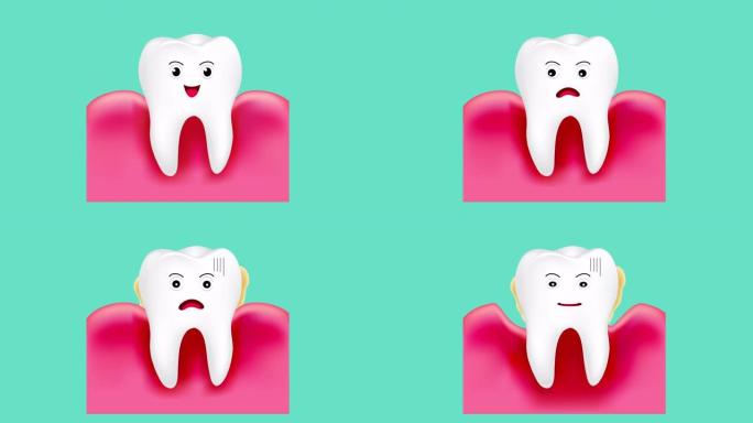 牙龈疾病的步骤。健康的牙齿和牙龈炎。