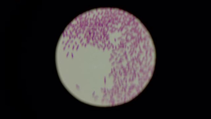 念珠菌真菌在显微镜下的孢子。念珠菌微生物。实验室和医学研究概念。